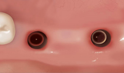 �׺���̼� ���ö�Ʈ